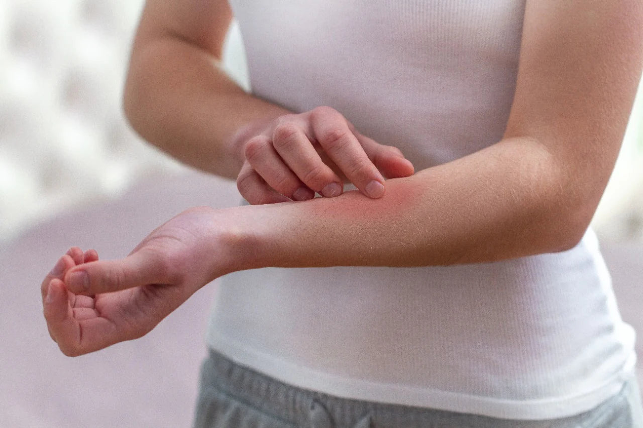 The Itch Factor: Understanding What Causes Itchy Skin โ mars by GHC
