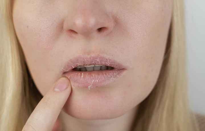 7 Effective Ways To Cure Chapped Lips Effectively mars by GHC 7 Effective Ways To Cure Chapped Lips Effectively mars by GHC