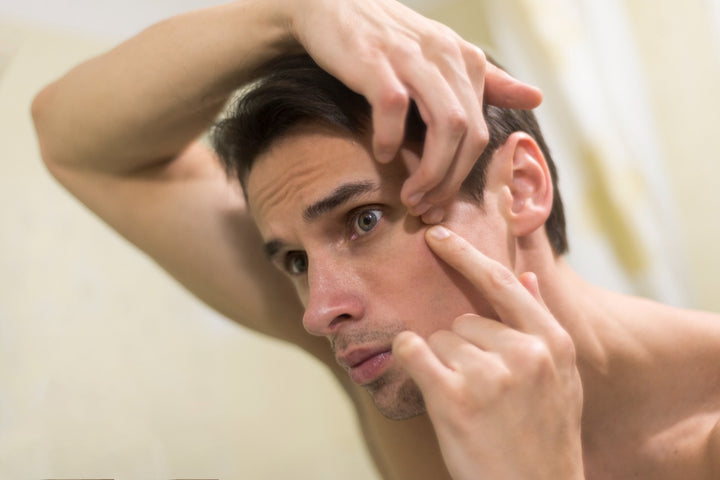 a man examining his dry acne-prone skin