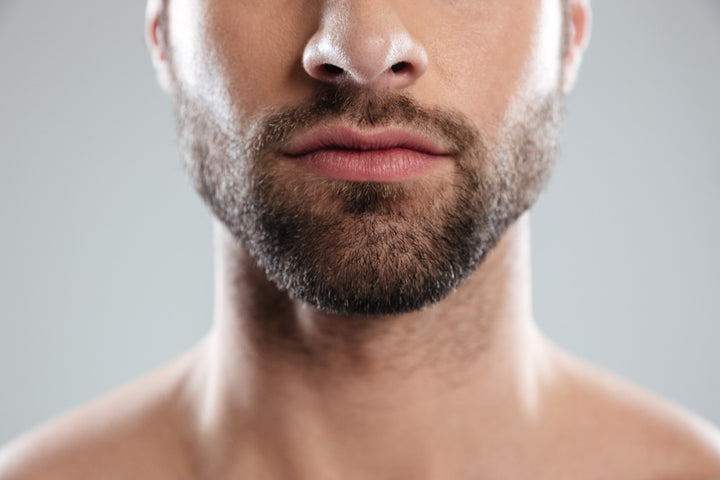 Bald spots in beard