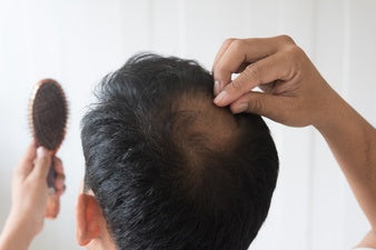 How to stop hair loss 