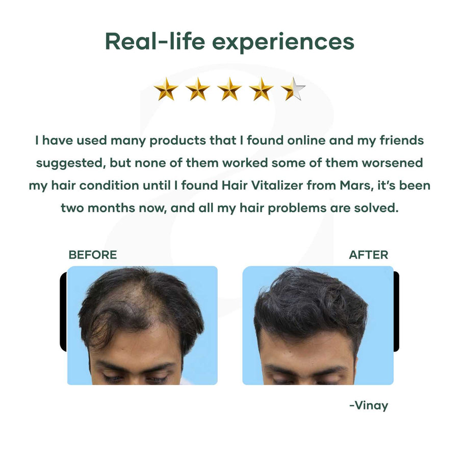 Hair Vitalizer with 1% Redensyl