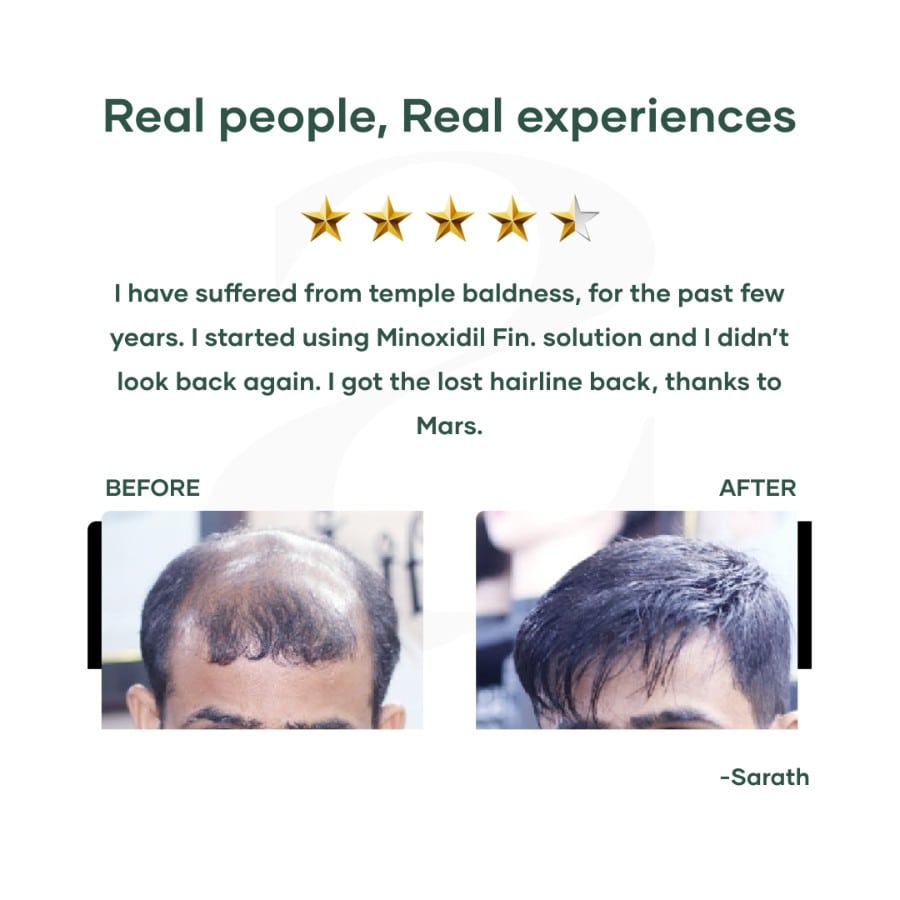 Best Hair regrowth serum for hair regrowth mars by GHC Best Hair regrowth serum for hair regrowth mars by GHC