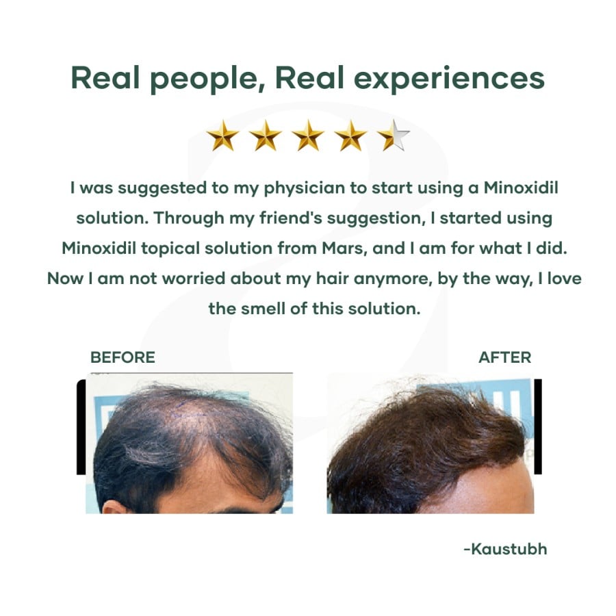 Minoxidil Solution for Hair Regrowth (60 mL) | Minoxidil 5% Topical Solution | Best Hair Loss Treatment