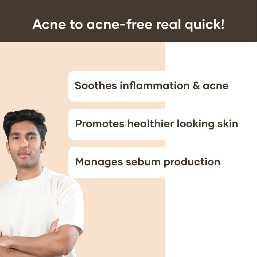 Benefits of anti acne gel
